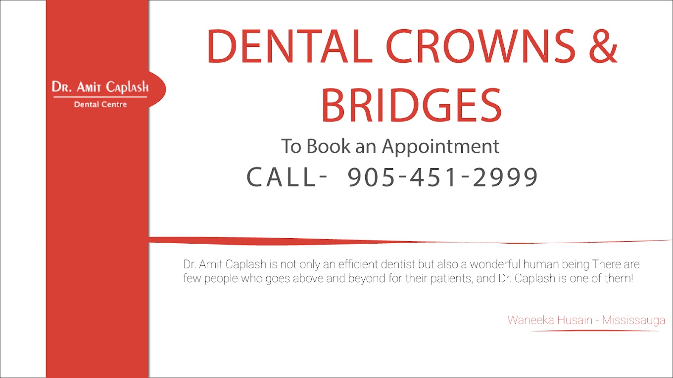 Dr amit Caplash Dental crowns & bridges
