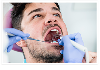 Caplash Dental tooth extraction