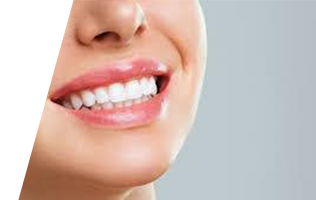 Gingivoplasty Tratment Brampton