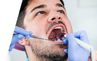Tooth extraction Brampton