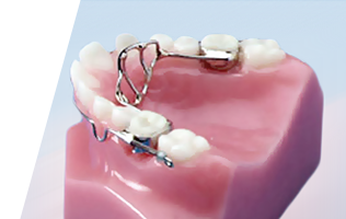 Caplash Dental Habit Breaking Appliances Brampton